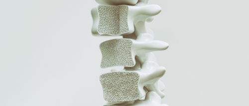 Ame os seus ossos - Projeto o seu futuro