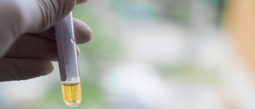 prueba de biuret en protein número uno para desmontar de peso