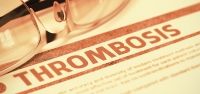 Trombose na Mulher: um novo desafio na Ginecologia e Obstetr&iacute;cia?