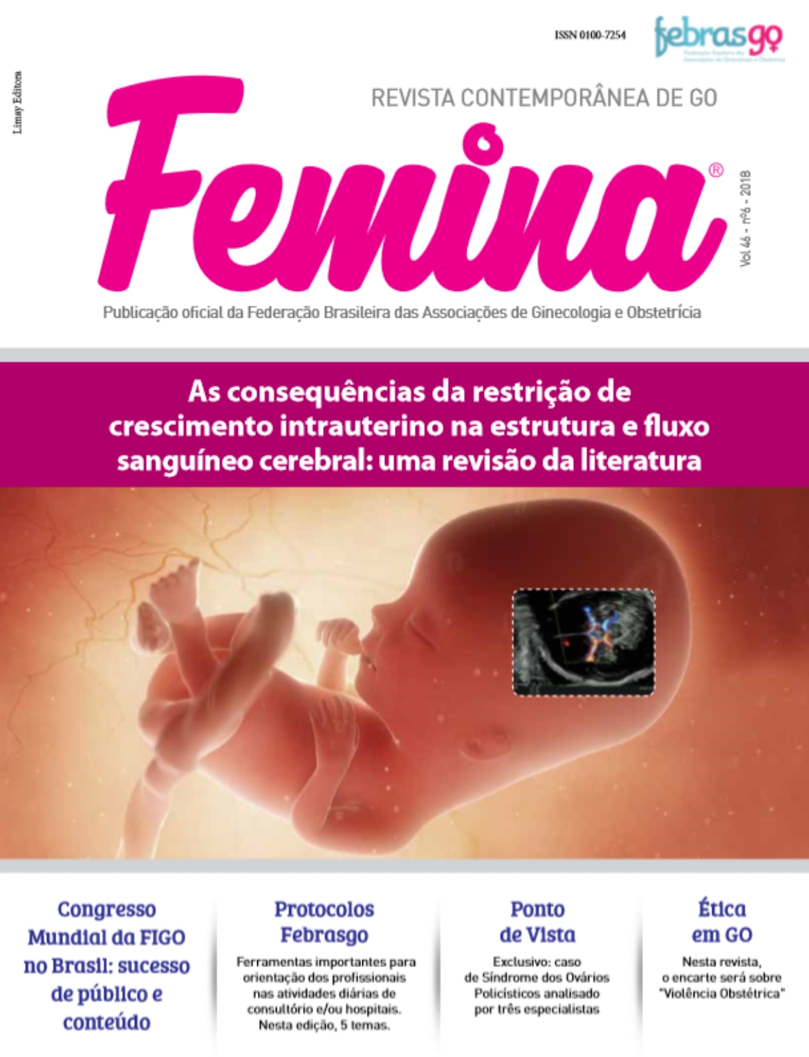 Revista Femina - 2018 | Vol 46 | nº 6