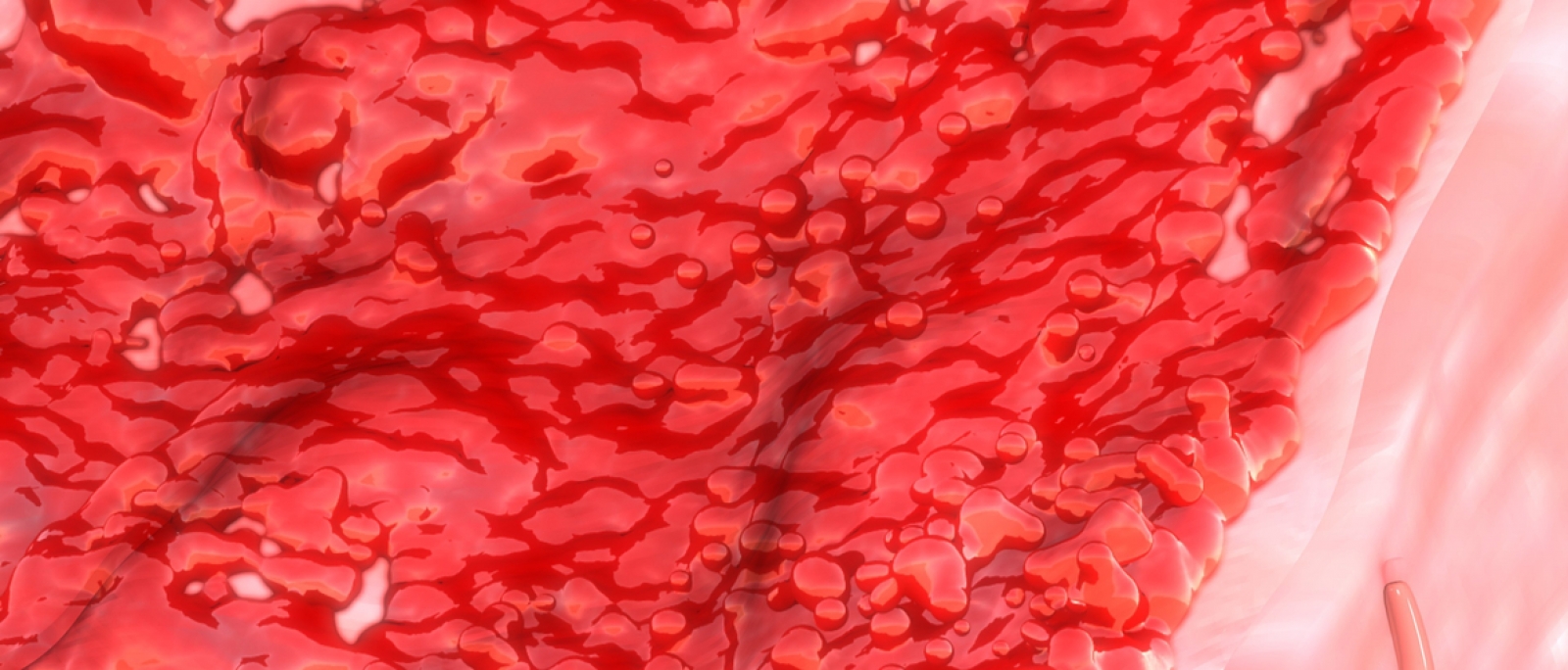 Menstruação com coágulos: 7 principais causas (e o que fazer