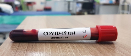 Como interpretar os testes para infecção por SARS-CoV-2 (Coronavírus) em pacientes suspeitos ou com COVID-19