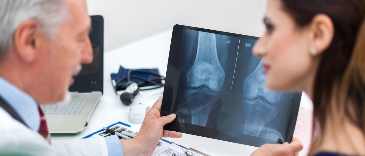Por que o Ginecologista deve se envolver no rastreamento, prevenção e tratamento da Osteoporose?