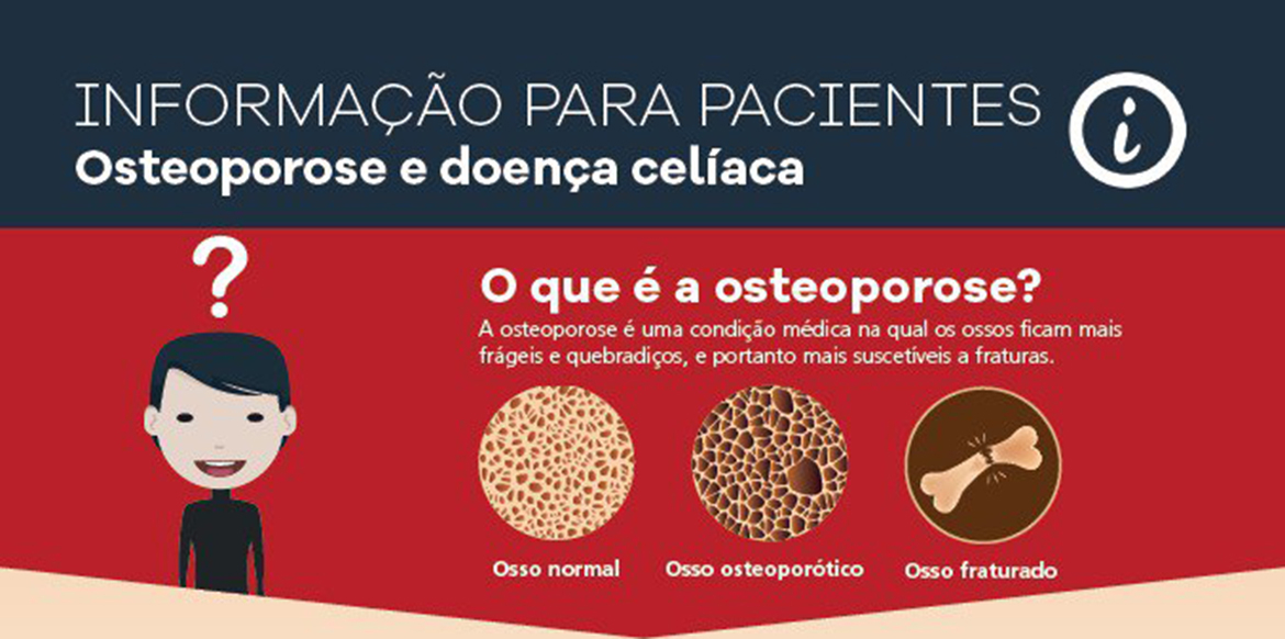 Doença Celiaca e Osteoporose