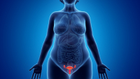 A obesidade feminina e as consequências na saúde ginecológica